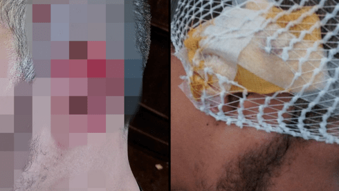 A bouncer's ear was partially severed after an altercation with a customer at an Israeli nightclub.